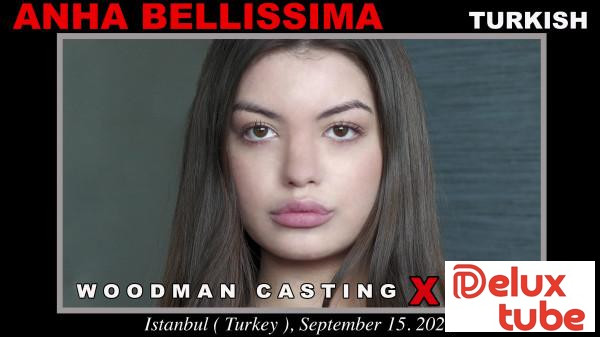 [ Woodman Casting X ] * UPDATED *